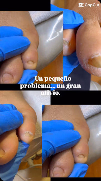 Nail work by Daymar Quiropedia 2020