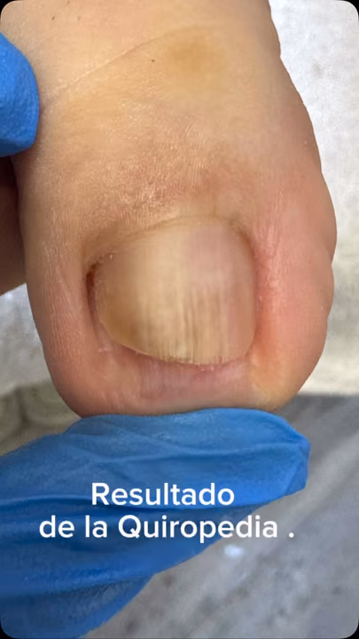 Nail work by Daymar Quiropedia 2020