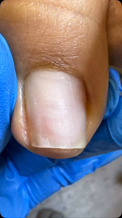 Nail work by Daymar Quiropedia 2020