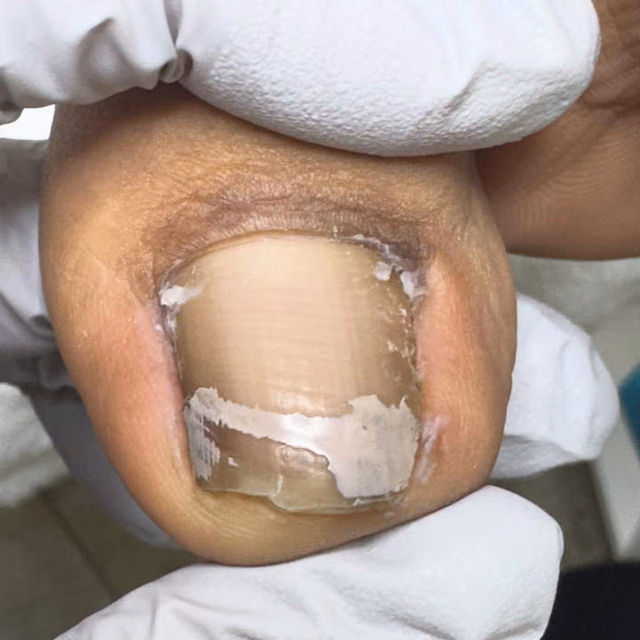 Nail work by Daymar Quiropedia 2020