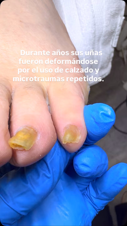 Nail work by Daymar Quiropedia 2020