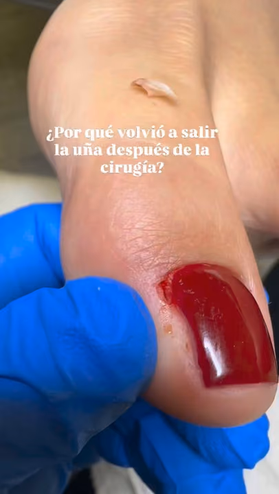 Nail work by Daymar Quiropedia 2020