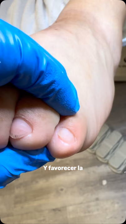 Nail work by Daymar Quiropedia 2020