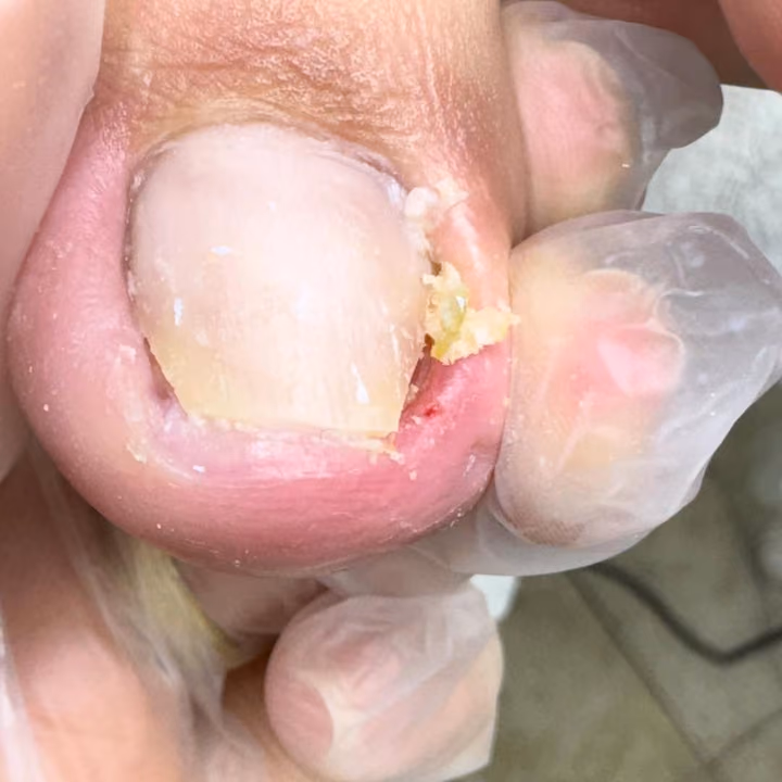 Nail work by Daymar Quiropedia 2020