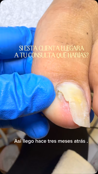 Nail work by Daymar Quiropedia 2020