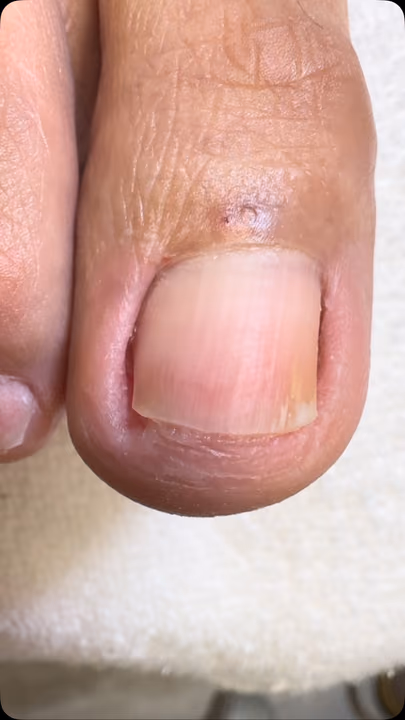 Nail work by Daymar Quiropedia 2020