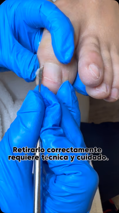 Cuticle Care — nail work by Daymar Quiropedia 2020