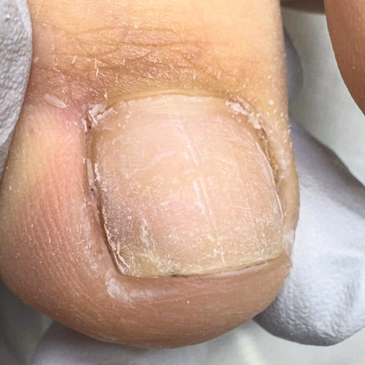 Nail work by Daymar Quiropedia 2020