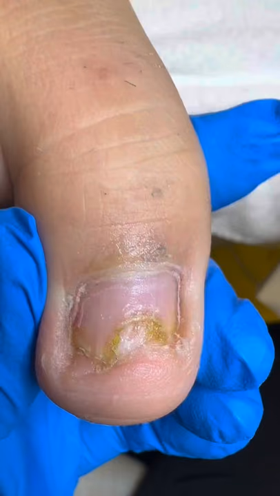 Nail work by Daymar Quiropedia 2020