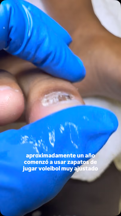 Nail work by Daymar Quiropedia 2020